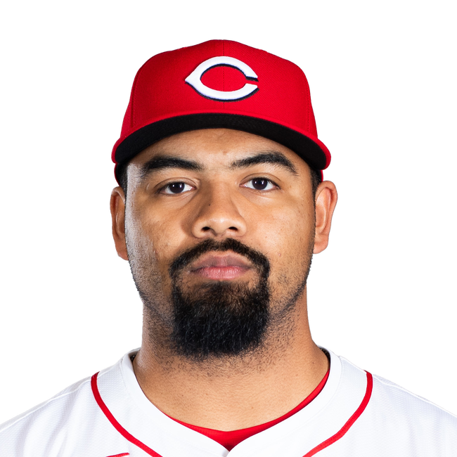Tony Santillan